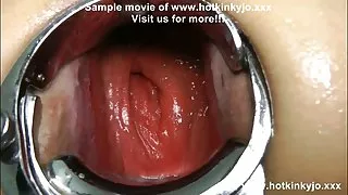 جنس نر, اسباب او ممکن است در پورنو آنلاین, خیابان, شلوار, بعدی جوجه